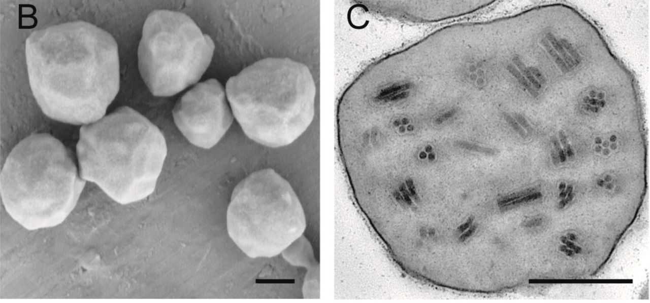 Scanning electron microscopy (SEM, left) and transmission electron microscopy (TEM, right) images of baculovirus occlusion bodies (OBs) isolated from an infected larva.